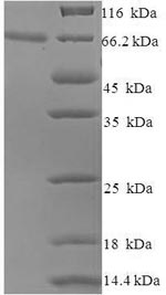 SDS-PAGE