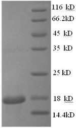 SDS-PAGE