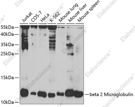 Вестерн-блоттинг, beta 2 Microglobulin, различные клеточные линии