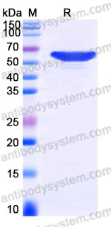 YHJ50302, SDS-PAGE