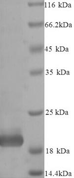 SDS-PAGE