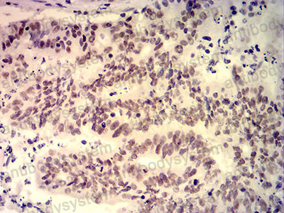 Валидация AntibodySystem RHK46103 (3674)