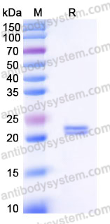 YHJ51202, SDS-PAGE