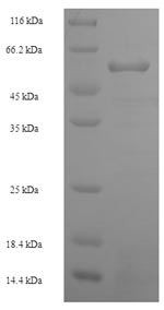 SDS-PAGE