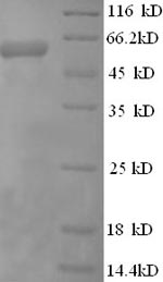 SDS-PAGE