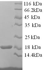SDS-PAGE
