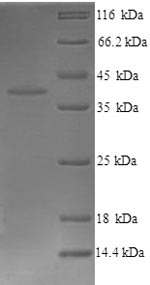 SDS-PAGE
