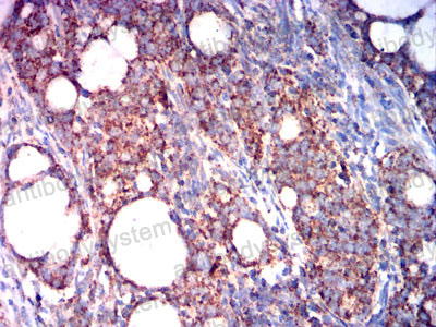 Валидация AntibodySystem RHD01402 (1275)