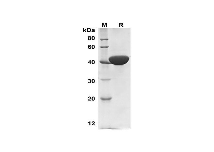 PDEH101140, электрофорез в ПААГ с ДСН