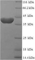 SDS-PAGE
