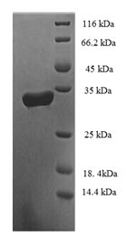 SDS-PAGE