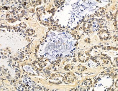 Валидация Affinity DF15580 - 11997