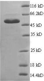 SDS-PAGE