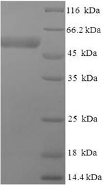 SDS-PAGE