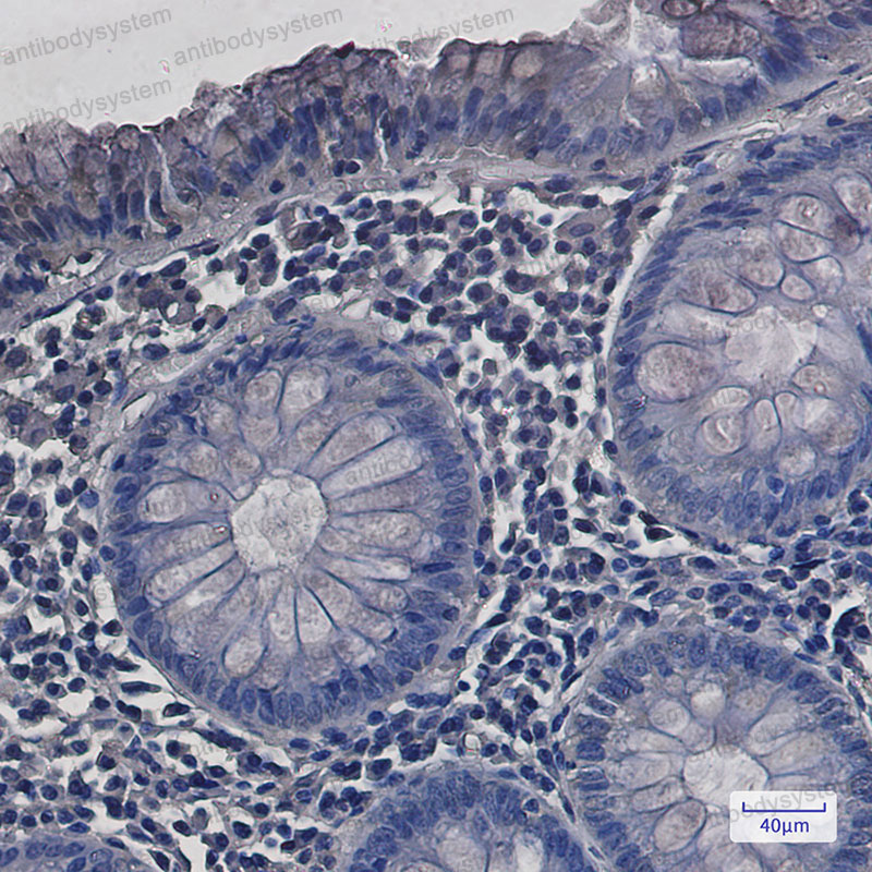 Валидация AntibodySystem RHD92701