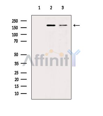 Валидация Affinity DF6578 - 18014