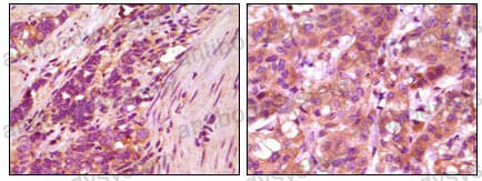 Валидация AntibodySystem RHJ74001