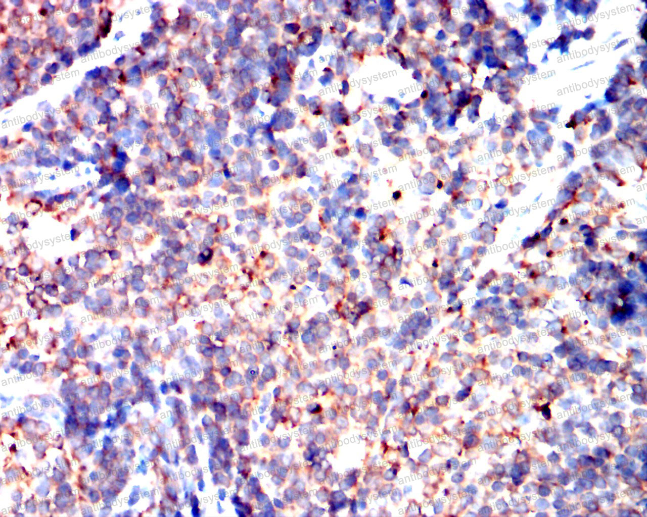 Валидация AntibodySystem RHE35201 (2099)