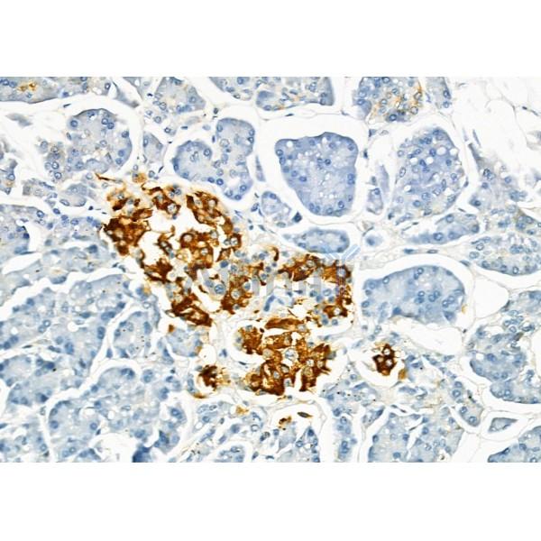 Валидация Affinity AF9111 - 4886