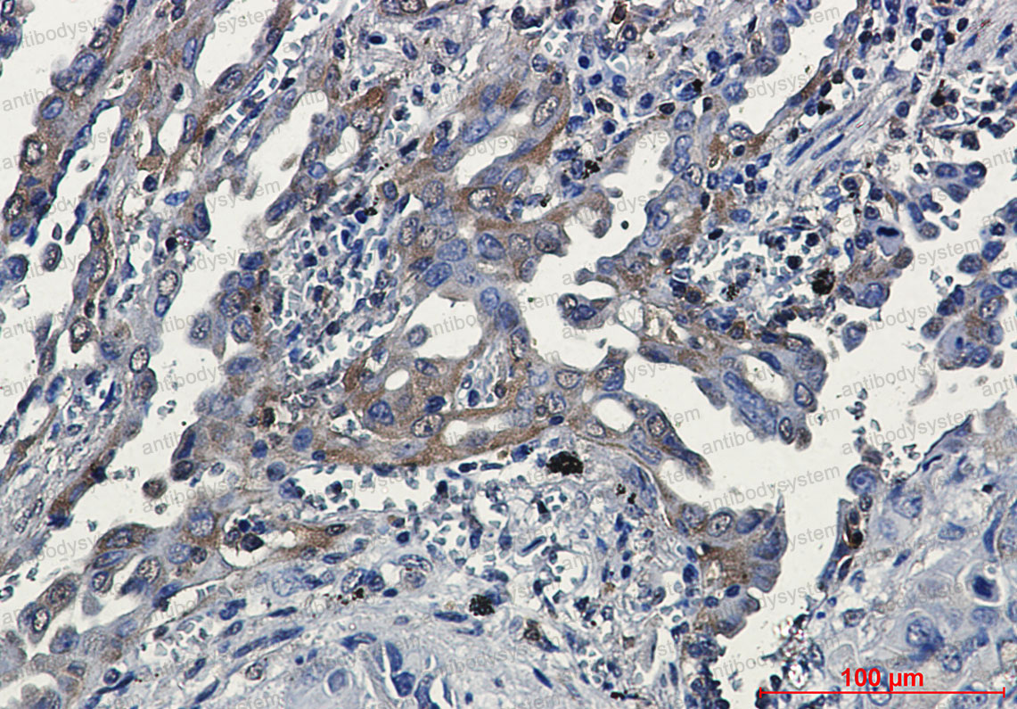 Валидация AntibodySystem RHH07101