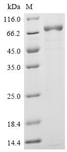 SDS-PAGE