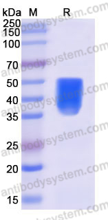 AHK27203, SDS-PAGE