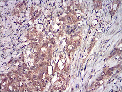 Валидация AntibodySystem RHE14402 (1989)