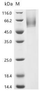 SDS-PAGE