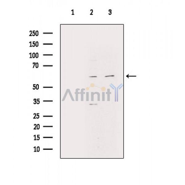 Валидация Affinity DF6868 - 18448