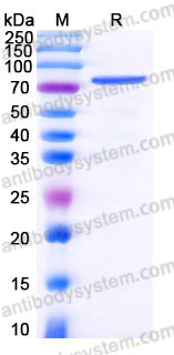 AHC02101, SDS-PAGE
