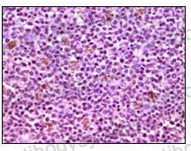 Валидация AntibodySystem RHG13402