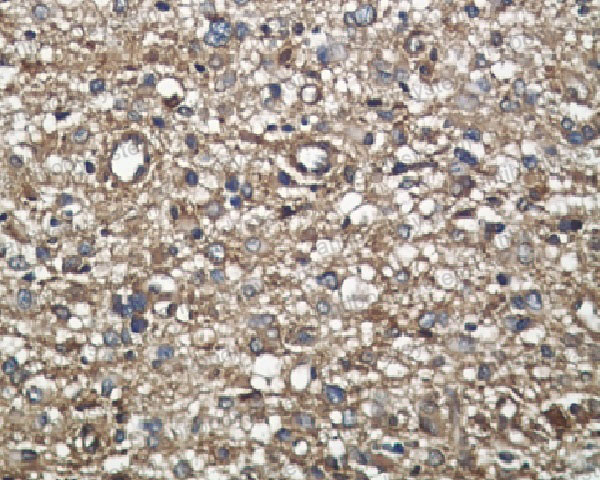 Валидация AntibodySystem RHD47402