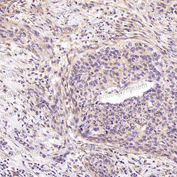 Валидация AntibodySystem RHK53201 (3692)