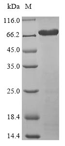SDS-PAGE