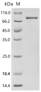 SDS-PAGE
