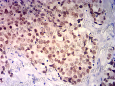 Валидация AntibodySystem RHD60505