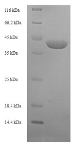 SDS-PAGE
