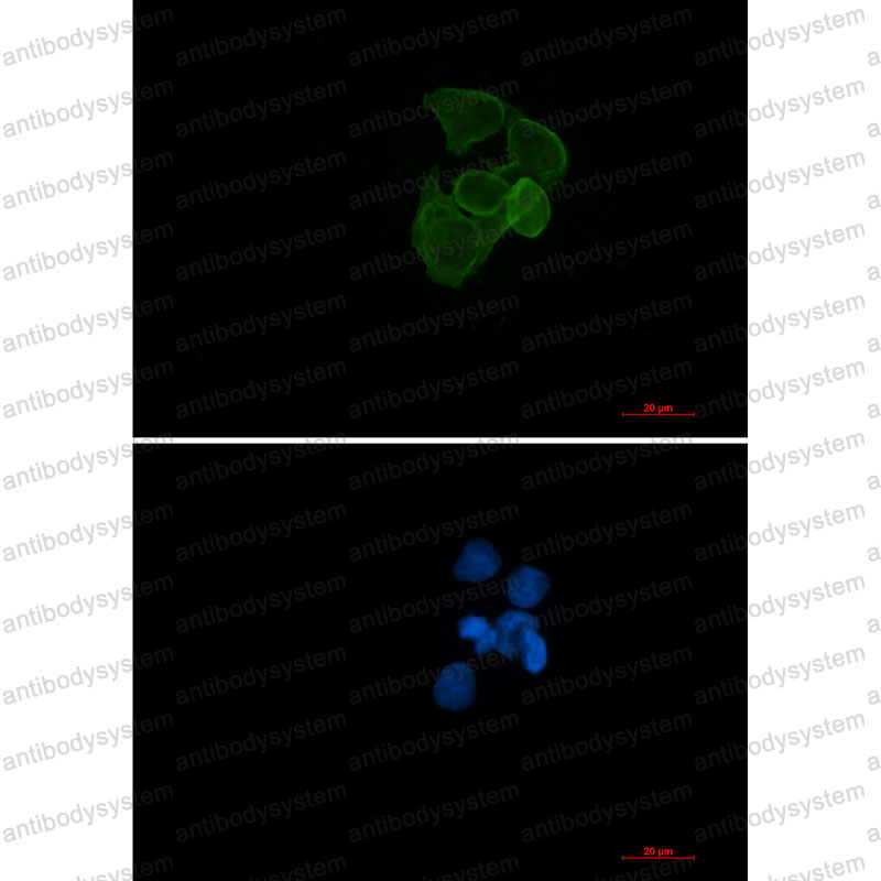 Валидация IF - AntibodySystem RHF62107