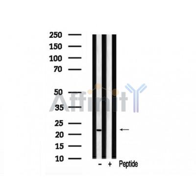 Валидация Affinity AF7953 - 4711