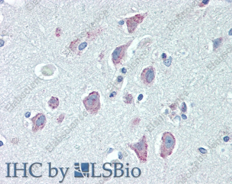 Иммуногистохимия, RGS4, ткань коры головного мозга