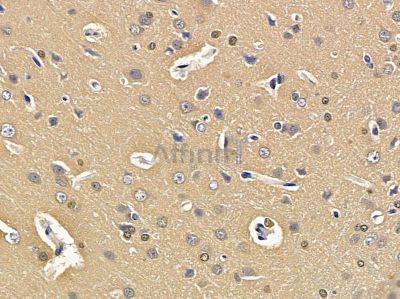 Валидация Affinity DF3494 - 14415