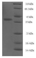 SDS-PAGE