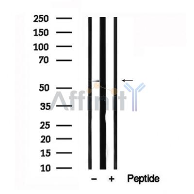 Валидация Affinity AF7640 - 4315