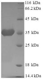 SDS-PAGE