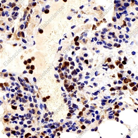 Иммуногистохимия, Galectin 3, ткань легкого мыши