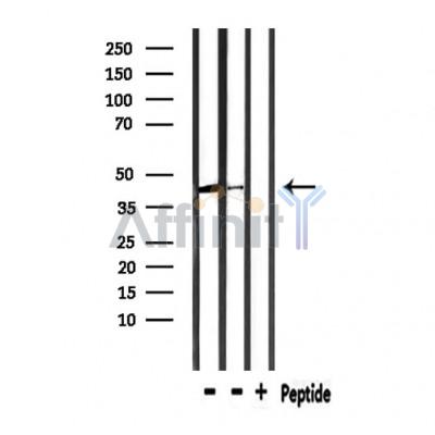 Валидация Affinity DF10205 - 5761