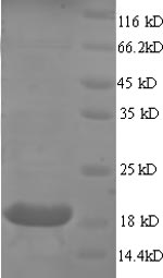 SDS-PAGE