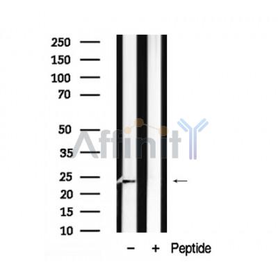 Валидация Affinity AF7910 - 4656