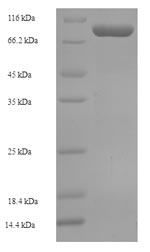 SDS-PAGE