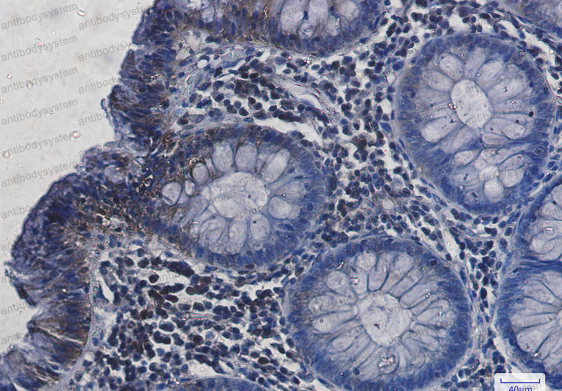 Валидация AntibodySystem RHC85601